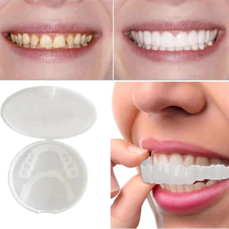 Removable Dental Veneers | Snap On Teeth Cover-Beauty-Sasha Sydney