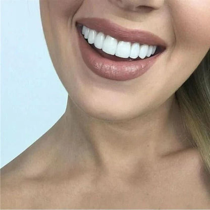Removable Dental Veneers | Snap On Teeth Cover-Beauty-Sasha Sydney
