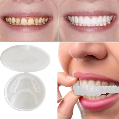 Removable Dental Veneers | Snap On Teeth Cover-Beauty-Sasha Sydney