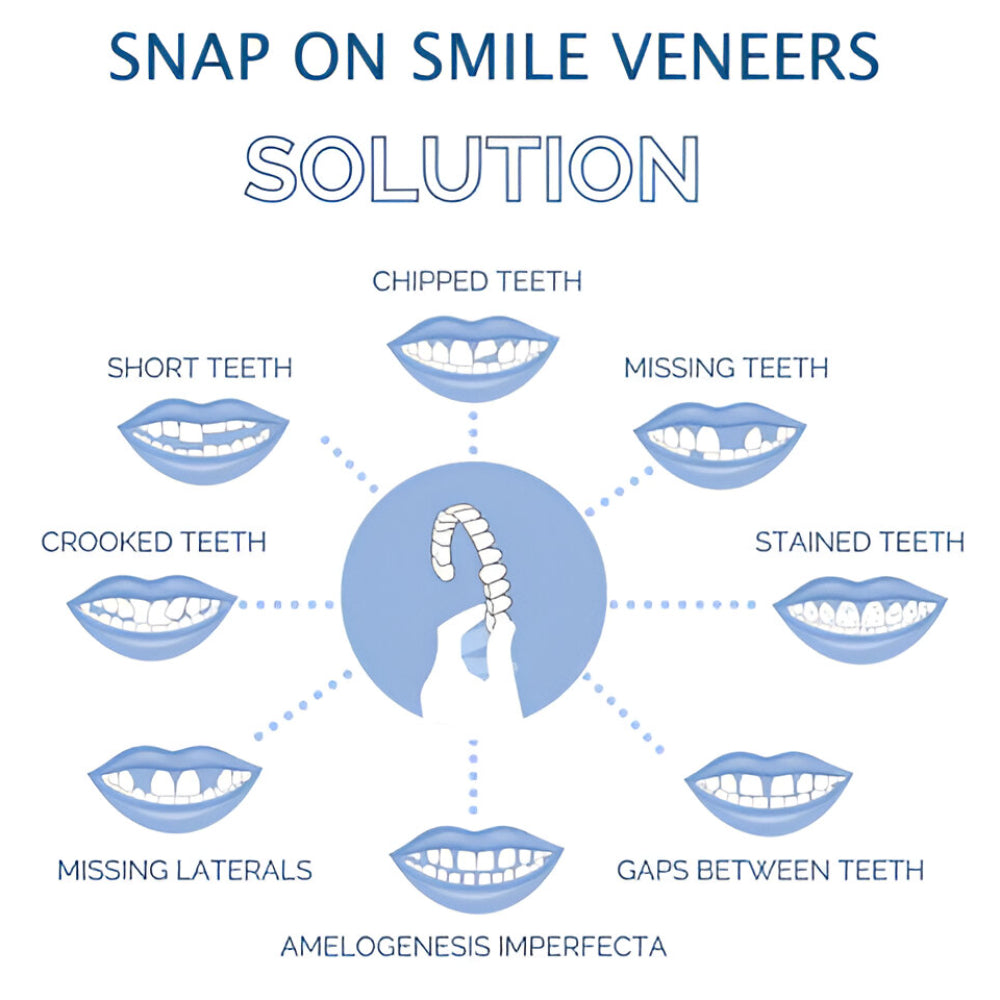 Snap On Teeth Veneers | Reusable · Sasha Sydney