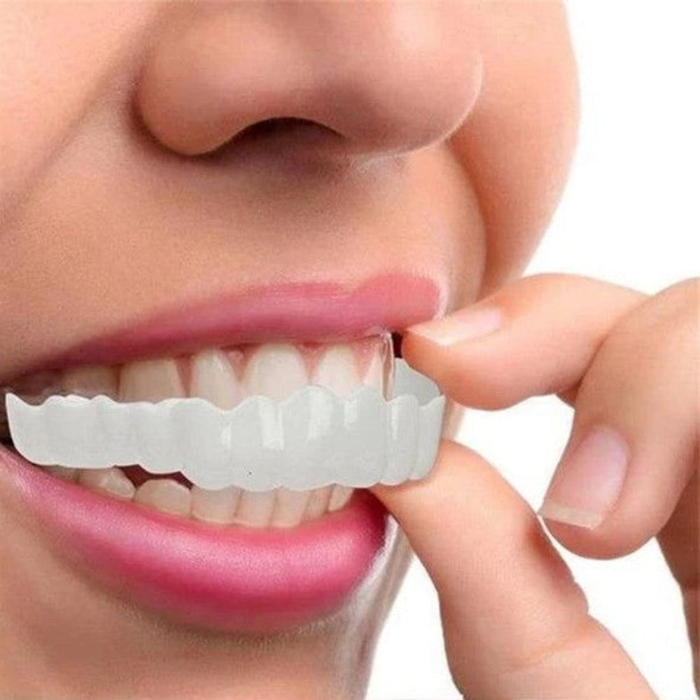 Snap On Teeth Veneers | Reusable · Sasha Sydney
