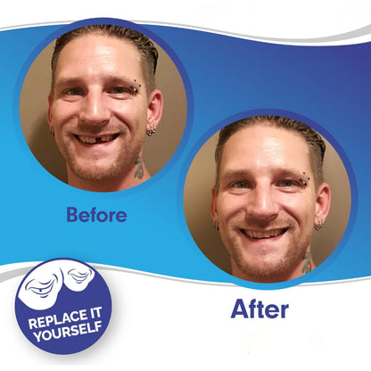 Snap On Teeth Veneers | Reusable · Sasha Sydney