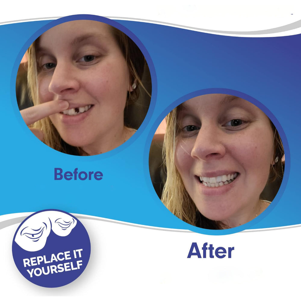 Snap On Teeth Veneers | Reusable · Sasha Sydney