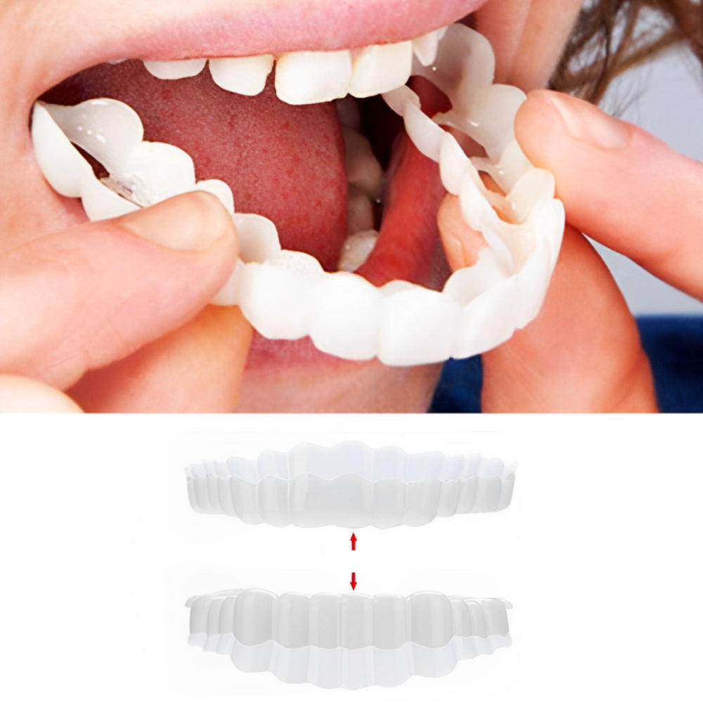 Snap On Teeth Veneers | Reusable · Sasha Sydney