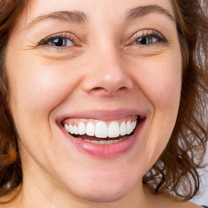 Snap On Teeth Veneers | Reusable · Sasha Sydney
